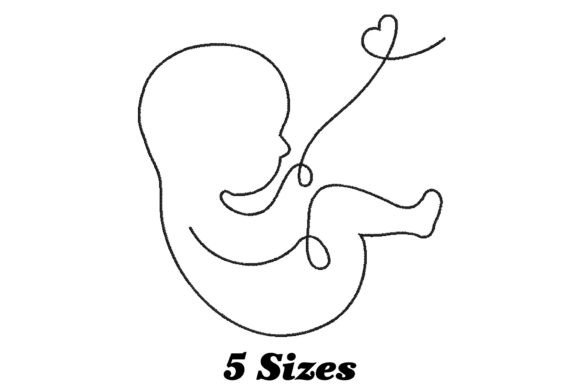 Baby Umbilical Cord: A Whimsical Nursery Design Review